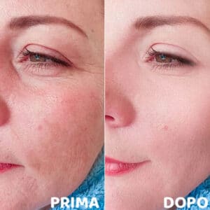 prima e dopo 1