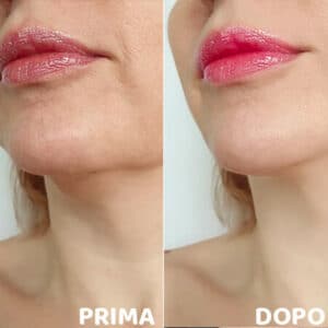 prima e dopo 33