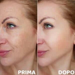 prima e dopo 4